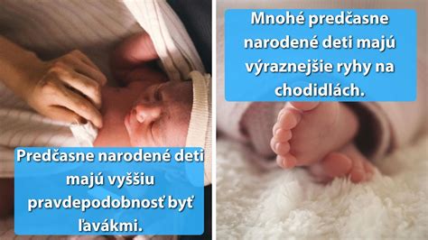 Infografika o predčasne narodených deťoch