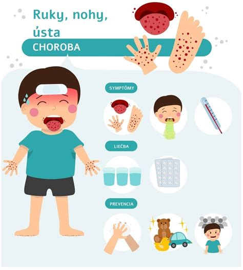 Choroba ruky, nohy, ústa: Všetko, čo potrebujete vedieť