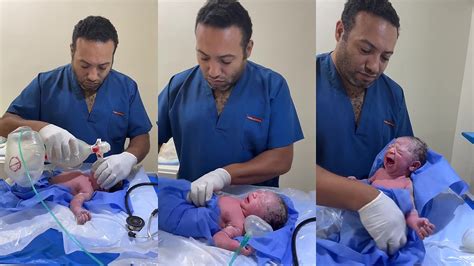 Novorodenec po cisárskom reze