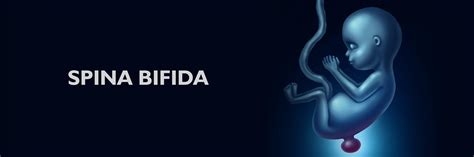Spina Bifida a Cisársky Rez: Komplexný Pohľad