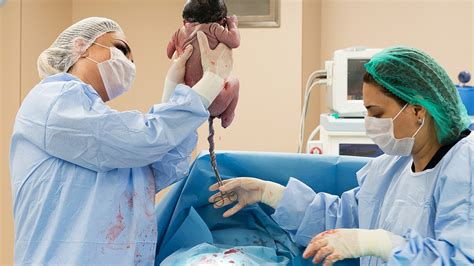 Cisársky rez: Od urgentného zásahu k plánovanej operácii s dôrazom na časový interval