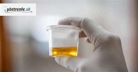 Ilustrácia dehydratácie a jej vplyvu na farbu a zápach moču