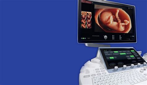 4D ultrazvukové vyšetrenie v Slovenskej republike: Pohľad do sveta prenatálnej diagnostiky