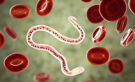 Ilustrácia rôznych typov parazitov v ľudskom tele