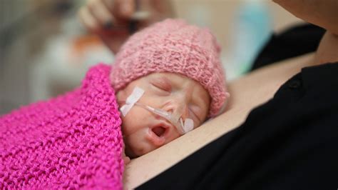 Predčasne narodené deti: Výzvy a starostlivosť na Slovensku