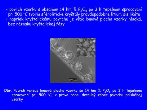 Schematické znázornenie diagnostických metód pri PCOS