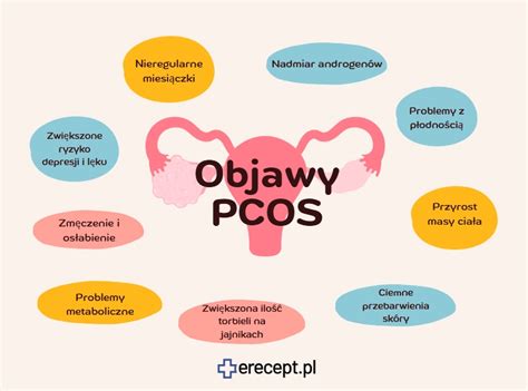 Infografika: Možnosti liečby PCOS