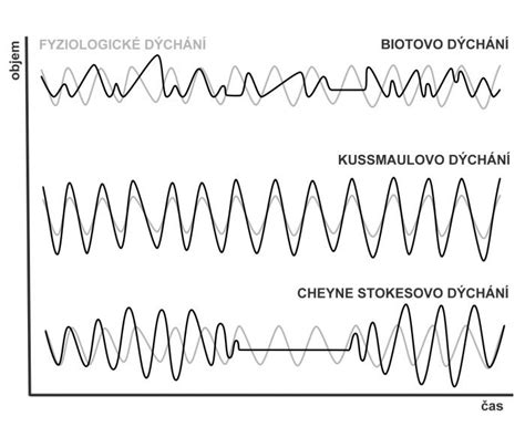 Schéma znázorňujúca Cheyne-Stokesovo dýchanie