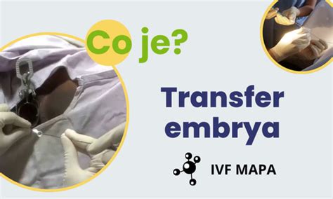 Schéma procesu IVF: od stimulácie po transfer embrya
