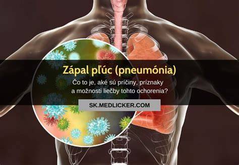 Infografika: Ako vzniká zápal pľúc a čo ho spôsobuje