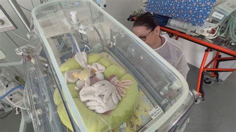 lekárska starostlivosť o predčasne narodené deti v inkubátore