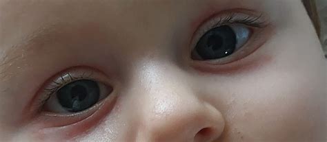 Genetika farby pleti, očí a vlasov u dieťaťa z páru s svetlou pleťou: čo hovoria dáta o dedičnosti