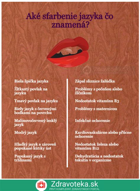 Infografika: Rôzne kreatívne spôsoby oznámenia tehotenstva