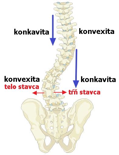 Ilustrácia chrbtice s vyznačeným zakrivením pri skolióze