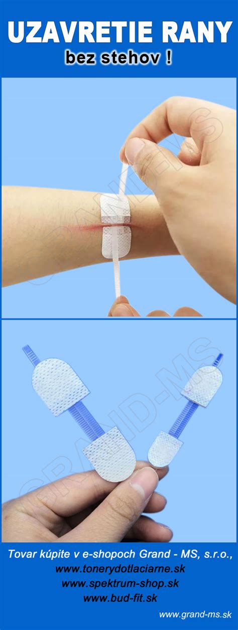 Obrázok zobrazujúci správne ošetrenie rany po uhryznutí.