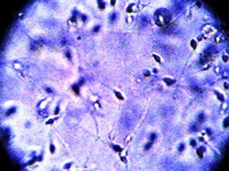 Ako vyzerá ľudská spermia pod mikroskopom: stavba a funkcia