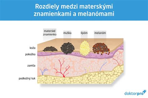 Rozdiely medzi materskými centrami a jasľami: Komplexný pohľad