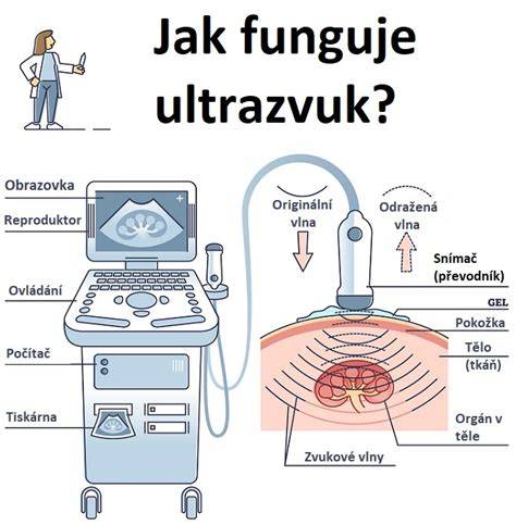 Infografika: Ako funguje ultrazvuk prsníkov