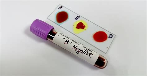 Krvné skupiny: Všetko, čo potrebujete vedieť
