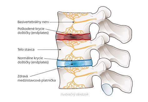 Schéma priebehu nádchy a zmeny konzistencie hlienu