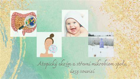 Infografika: Potravinové spúšťače atopického ekzému a ich prevencia