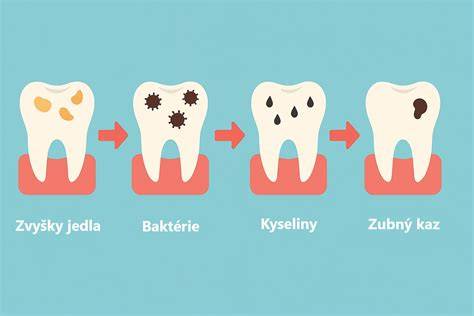 Infografika: Ako funguje zubný benefit a kto naň má nárok