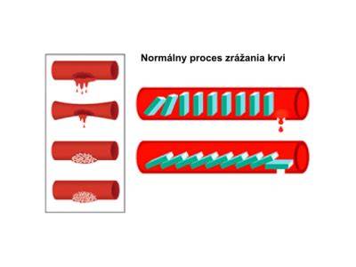 Porovnanie normálneho a predčasného zrastania fontanel