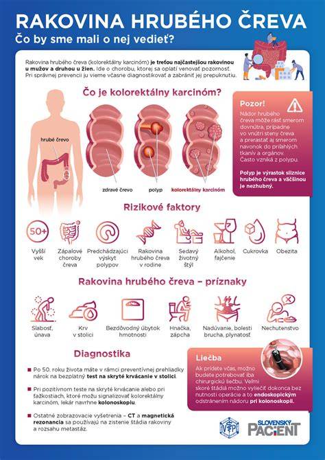 Infografika: Prepojenie stravy, čreva a nálady