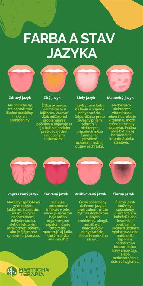Infografika: Ako sa tvorí povlak na jazyku a prečo vzniká pri diéte
