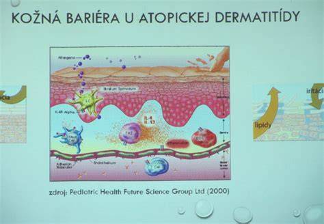 Infografika: Schéma príčin a liečby periorálnej dermatitídy