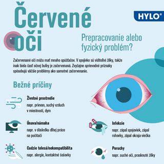 Infografika: Červené oko a bežné príčiny