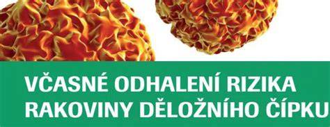 Infografika: Vztah diéty a rizika rakoviny prsníka