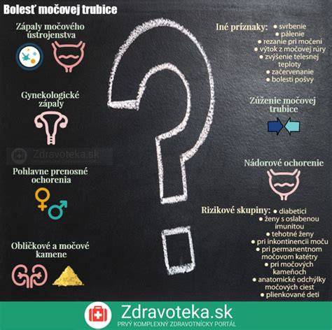 Infografika: Typy močovej inkontinencie a ich príčiny