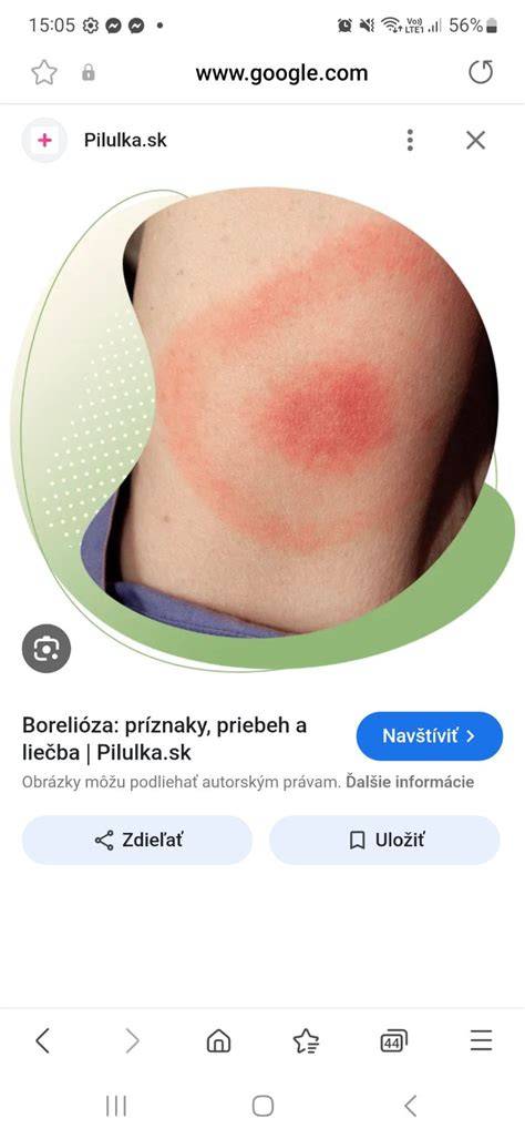 Ako sa stravovať pri borelióze po uhryznutí kliešťom a ako sa brániť voči ďalším chorobám