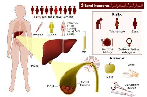 Infografika: Základné stavebné kamene diéty po amputácii