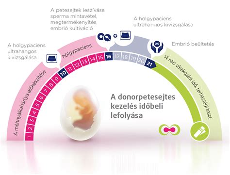 infografika priebeh IVF