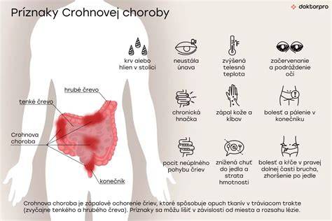 Infografika: Základy výživy pri CHOO a Crohnovej chorobe