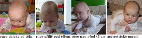 Dieťa v polohe pasenie koníkov s lakťami v trojuholníkovej polohe