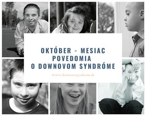 Grafika s informáciami o Downovom syndróme