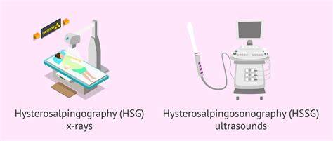 Infografika: HyFoSy vs HyCoSy vs HSG - porovnanie