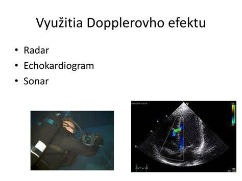 Infografika: princíp Dopplerovho efektu a vizualizácia toku krvi