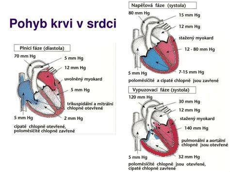 Infografika: Schéma normálneho priebehu krvi v srdci vs. krvný skrát pri DKS