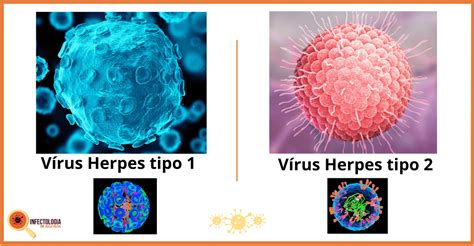 Vírus herpes simplex