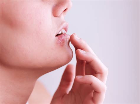 Genitálny herpes a pôrod: Komplexný pohľad