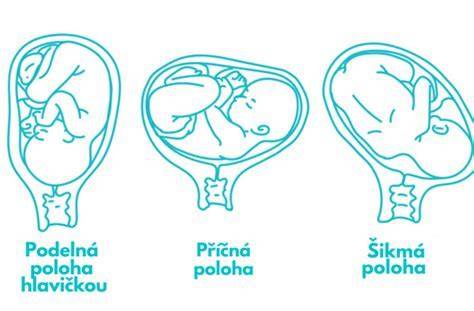 Schéma anatomickej polohy symfýzy a sakroiliakálnych spojení