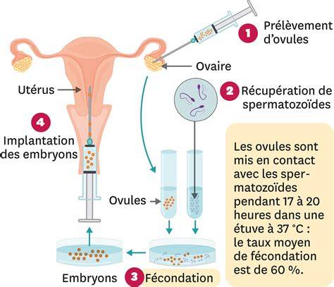 Schéma procesu IVF s OPU, kultiváciou a embryotransferom