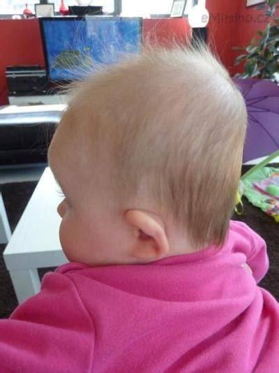Plocha hlavička u bábätka: príčiny a prevencia