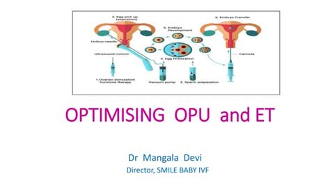 Schéma jednotlivých fáz IVF cyklu: stimulácia, OPU, ET