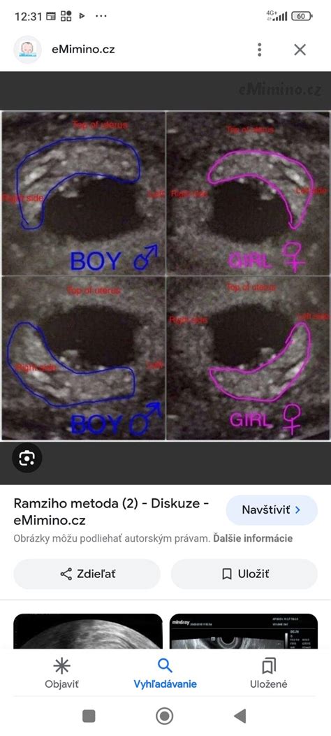 Infografika: Jonášova metóda a hlavn inspirácie (biorytmy, lunárne fázy, narodenie)