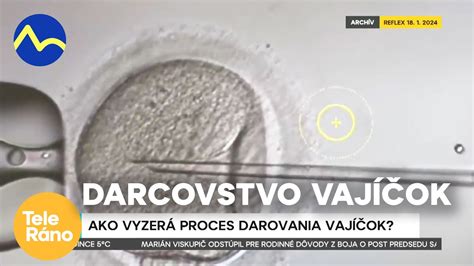 Infografika: Porovnanie darovania vajíčok a spermií
